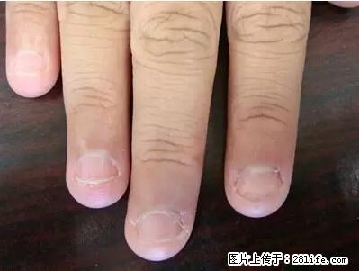 剪指甲、挖耳屎,这些日常小动作竟隐藏大危害! - 宜宾生活资讯 - 宜宾28生活网 yb.28life.com